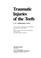 Cover of: Traumatic Injuries of the Teeth
