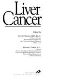 Cover of: Liver Cancer by Okuda, Kunio Okuda