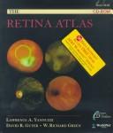 Cover of: The Retina Atlas CD-ROM | Lawrence A. Yannuzzi