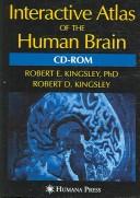 Cover of: Interactive Atlas of the Human Brain
