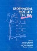 Esophageal Motility Testing