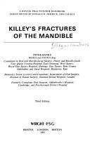 Cover of: Killey's fractures of the mandible