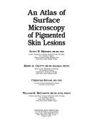 Cover of: An Atlas of surface microscopy of pigmented skin lesions