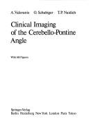 Clinical Imaging Of The Cerebello-pontine Angle by A. VALAVANIS