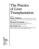 Cover of: The Practice of Liver Transplantation