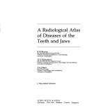 Radiological Atlas of Diseases of the Teeth and Jaws by R.M. Browne