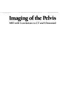 Cover of: Imaging of the Pelvis Mri With Correlations to Ct and Ultrasound