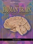 Cover of: The Human Brain, Photos Collection by John Nolte