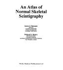 Cover of: atlas of normal skeletal scintigraphy