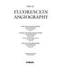 Atlas of fluorescein angiography by Barbara A. Harney, J. Christopher Dean Hart, Rodney H.B. Grey