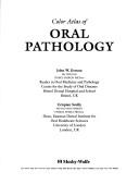 Color atlas of oral pathology by J. W. Eveson, Eveson