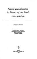 Cover of: Person identification by means of the teeth by Søren Keiser-Nielsen, Søren Keiser-Nielsen