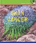 Skin Cancer (Health Alert) by Majorie L. Buckmaster