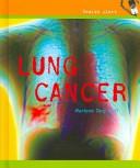 Cover of: Lung Cancer (Health Alert) by Marlene Targ Brill