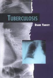 Cover of: Tuberculosis (Twenty-First Century Medical Library)