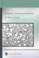 Cover of: Biopsy Interpretation of the Liver by Nadim Al-Mubarak