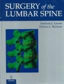 Cover of: Surgery Of The Lumbar Spine
