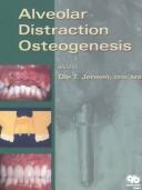 Cover of: Alveolar Distraction Osteogenesis by Ole T. Jensen