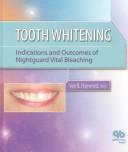 Cover of: Tooth Whitening by Van B. Haywood