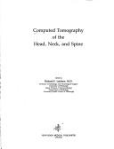 Cover of: Computed Tomography of the Head, Neck and Spine