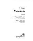 Cover of: Liver metastasis by edited by Leonard Weiss, Harvey A. Gilbert.