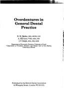 Overdentures in general dental practice by R. M. Basker