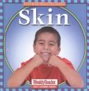 Skin by Cynthia Fitterer Klingel, Robert B. Noyed