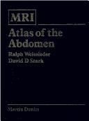 Cover of: MRI atlas of the abdomen