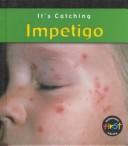Cover of: Impetigo (It's Catching)