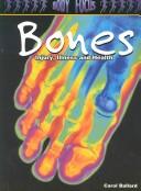 Cover of: Bones: Injury, Illness and Health (Body Focus: the Science of Health, Injury and Disease) by Carol Ballard