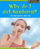 Cover of: Why Do I Get Sunburn? by Angela Royston