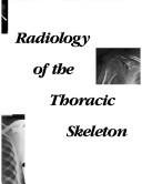 Radiology of the thoracic skeleton by William W. Scott, William W. Scott, Penelope P. Scott, Scott O., M.D. Trerotola