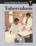 Tuberculosis