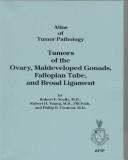 Cover of: Tumors of the ovary, maldeveloped gonads, fallopian tube, and broad ligament by Robert E. Scully