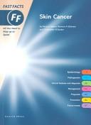 Cover of: Skin Cancer Fast Facts: All You Need to Keep up to Speed (Fast Facts)
