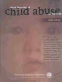 Cover of: Visual Diagnosis of Child Abuse