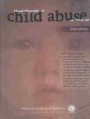 Cover of: Visual Diagnosis of Child Abuse by American Academy of Pediatrics