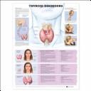 Cover of: Thyroid Disorders Anatomical Chart by Anatomical Chart Company