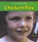 Cover of: Chicken Pox (It's Catching)