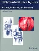 Cover of: Posterolateral Knee Injuries by Robert F., M.D., Ph.D. LaPrade, Robert F., M.D., Ph.D. LaPrade