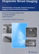 Diagnostic breast imaging by Sylvia H. Heywang-Köbrunner, Sylvia H. Heywang-Kobrunner, I. Scheer, David D. Dershaw