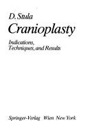 Cover of: Cranioplasty