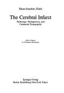 Cover of: The Cerebral Infarct by 