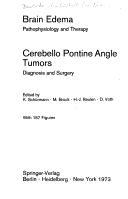 Brain Edema - Cerebello Pontine Angle Tumors by K. Schürmann, M. Brock, D. Voth