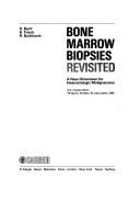 Cover of: Bone Marrow Biopsies Revisited: A New Dimension for Haematologic Malignancies