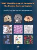 Cover of: Who Classification of Tumours of the Central Nervous System (Who Classfication of Tumours)