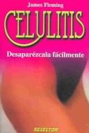 Celulitis