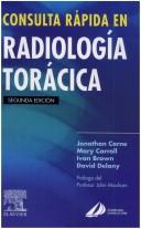 Cover of: Consulta Rapida en Radiologia Toracica