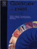 Cover of: Cancer de Piel con CD-ROM