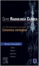 Cover of: Serie Pocket de Radiologia: Los 100 diagnosticos principales en columna vertebral (Serie Pocket De Radiologia)